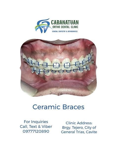 cabanatuan dental clinic|Dentista Dental Clinic .